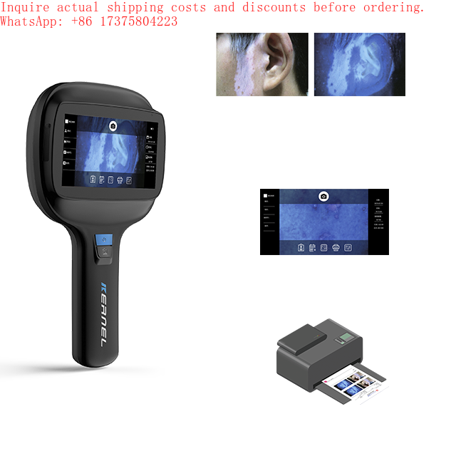 カーネル KN-9000A 診断機器 顔の水分テスト 顔分析 - Test Instruments のレビューと価格
